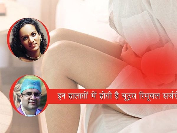 Uterus removal surgery